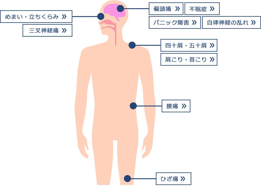 めまい 首 の 痛み 首の後ろが痛い！病院で見落とされやすい5つの病気はこれだ！