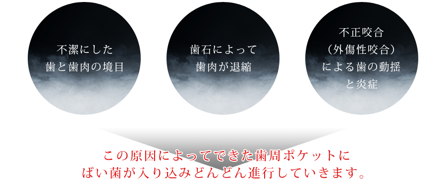 歯周病の原因の１番は細菌とカビです。